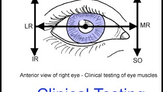 Clinical testing extraocular muscles tutorial [upl. by Ilrebmik]