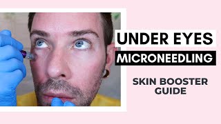 How To Microneedle Under Eye With PDRN Skin Booster  Curenex With Dr Pen Ft Vanidiy [upl. by Idnis]