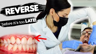 How To Treat Gum Disease [upl. by Grogan]