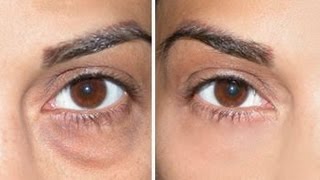 How to Cover Dark Circles  Under Eye Bags [upl. by Seilenna]