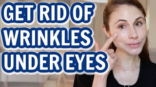 How to GET RID OF UNDER EYE WRINKLES Dr Dray [upl. by Evy]